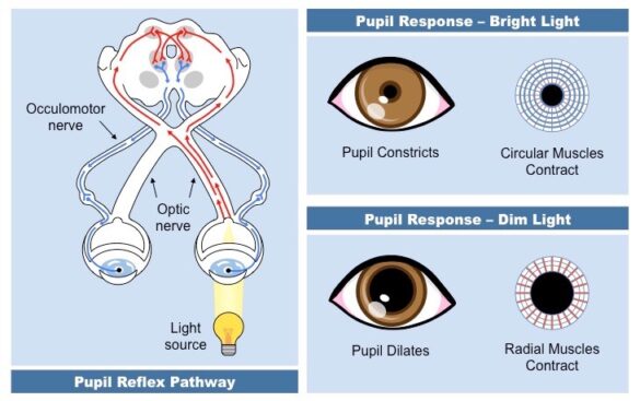 understanding-the-pupillary-light-reflex-and-its-role-in-diagnosing